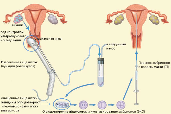 прогестерон при беременности
