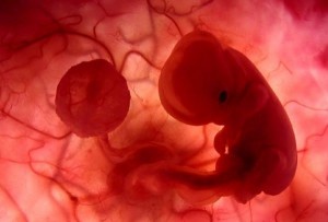 Плод на ранних сроках Виды прерывания беременности