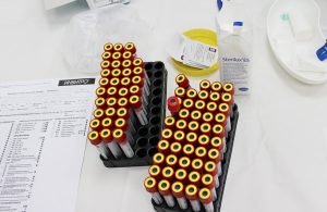 анализы крови Почему так опасен волчаночный антикоагулянт при беременности