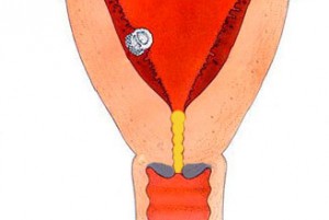 beremennost-i-mesyachnye какая шейка матки на ранних сроках беременности