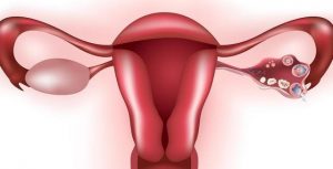 bolyat-yaichniki-posle-rodov Болят яичники после родов