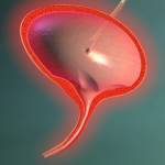 Причины цистита после родов Цистит после родов