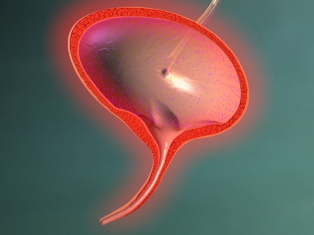 cistit-posle-rodov Цистит после родов