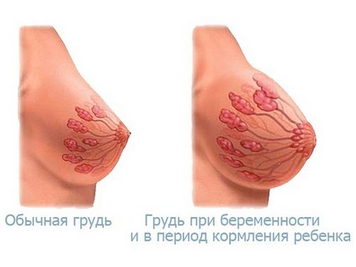 Грудь после родов Грудь до и после родов