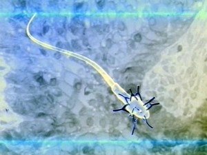 Иммунологическое бесплодие