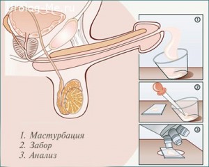 Анализ спермограммы Процесс сдачи спермограммы