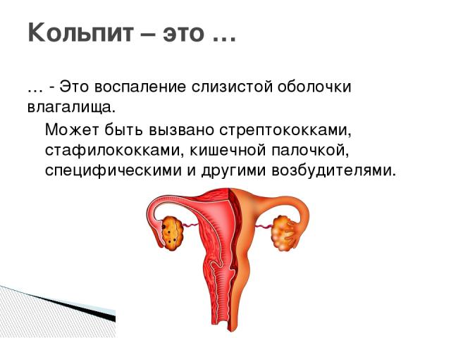 Что такое кольпит Кольпит