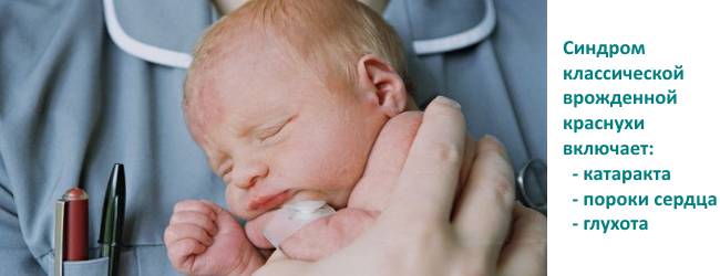 Больной малыш Влияние краснухи на плод
