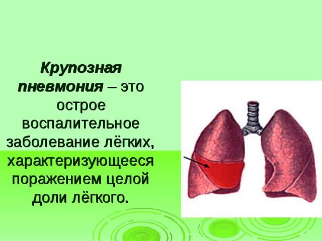 Что такое крупозная пневмония Крупозная пневмония