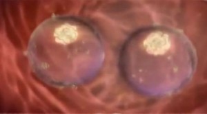 месячные на ранних сроках беременности