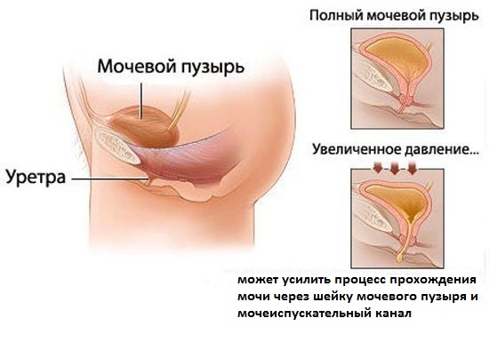 Причины недержания мочи Недержание мочи после родов