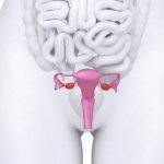 Планирование беременности при опущении матки Опущение матки и беременность