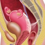 Причины опущения матки после родов Опущение матки после родов