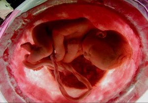 Результаты УЗИ Плод в утробе