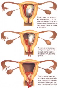кровь при беременности на ранних сроках