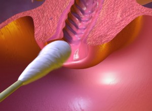 почему мажет на ранних сроках беременности