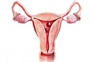 polip-posle-rodov Полип после родов