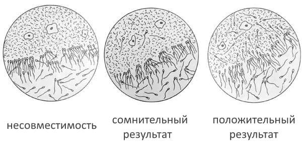 Посткоитальный тест