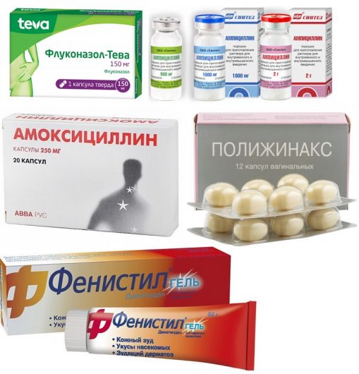 препараты при зуде во влагалище
