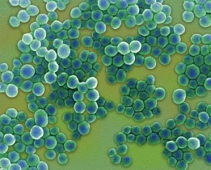 Признак беременности цистит