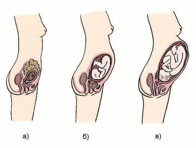 признаки беременности