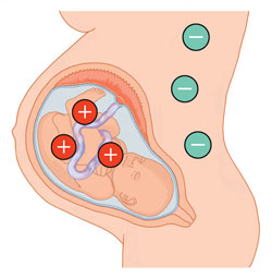 Резус конфликт на ранних сроках беременности