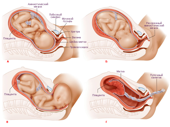 Родовые изгоняющие силы