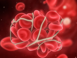 sgustki-v-matke-posle-rodov Сгустки в матке после родов