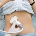 Причины субинволюции после родов Субинволюция матки после родов