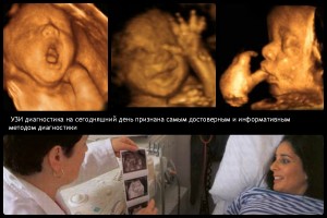 УЗИ на раннем сроке беременности