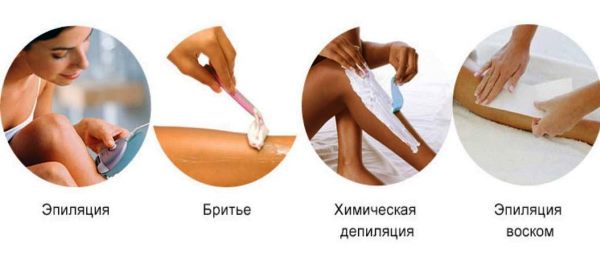 Виды эпиляции Эпиляция после родов