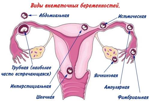 прогестерон при беременности