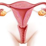 Воспаление матки после родов Причины и лечение воспаления матки после родов