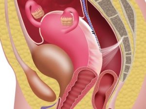 zagib-matki-posle-rodov Загиб матки после родов