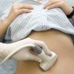 Замершая беременность Причины замершей беременности