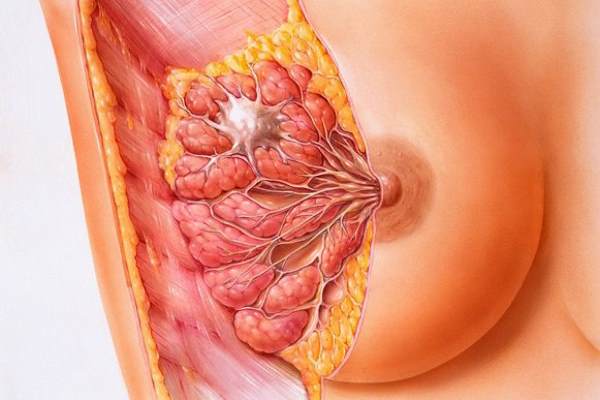 киста молочной железы