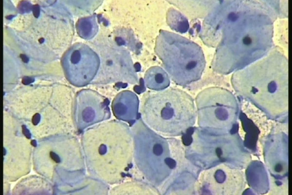 клетки эпителия