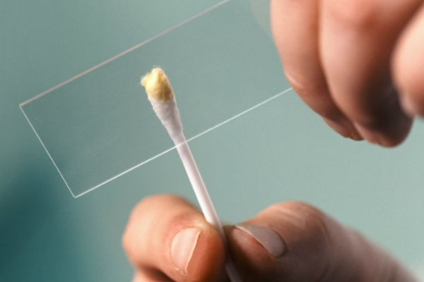 эстрогенный мазок