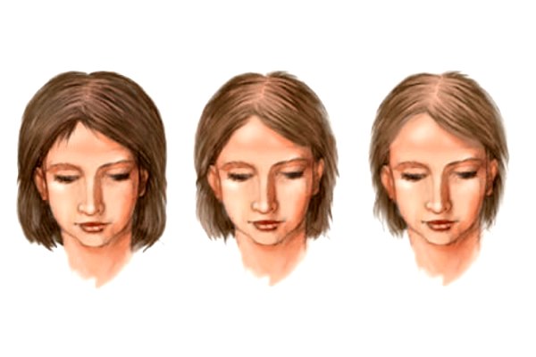 три женщины с разной шевелюрой