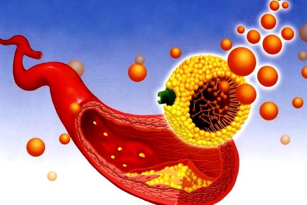 жиры в кровеносных сосудах