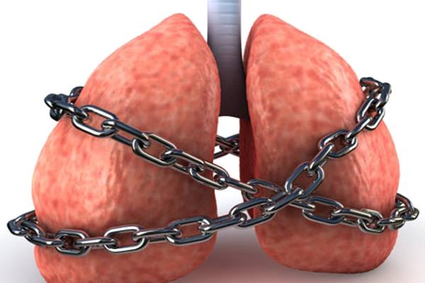 легкие скованы цепью