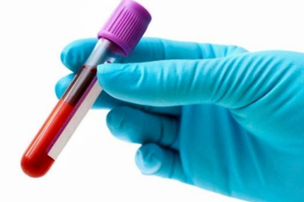кровь в пробирке