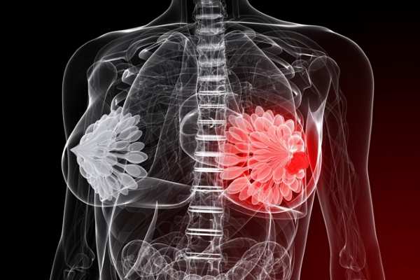 больная грудь рисунок