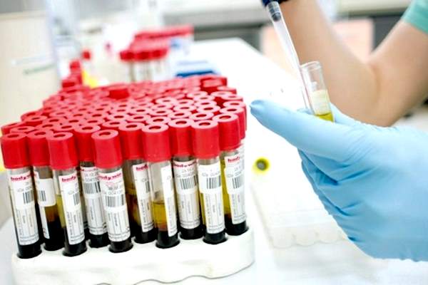 кровь в пробирках