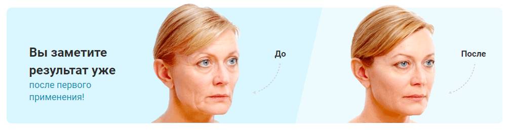 эффект после применения имиры