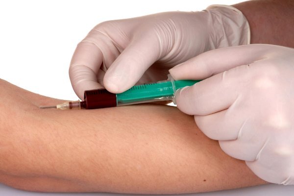 забор крови из вены