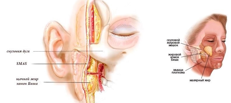 жировой комок биша