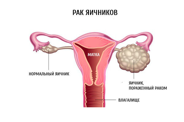 патология в организме