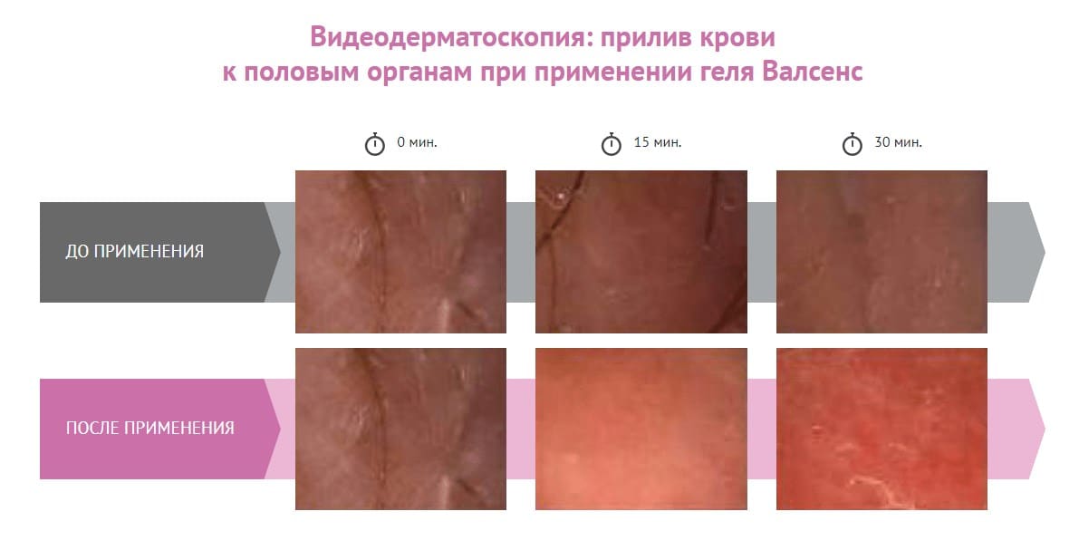 Видеодерматоскопия исследование валсенс